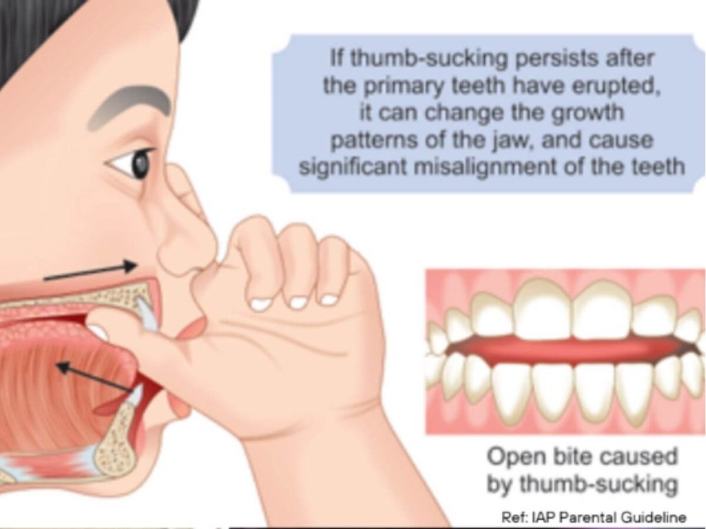 tongue and orofacial muscles