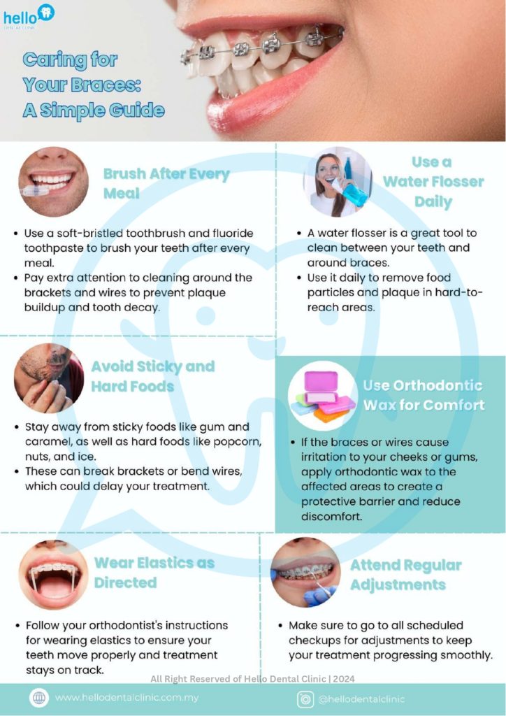 Caring for your braces: a simple guide