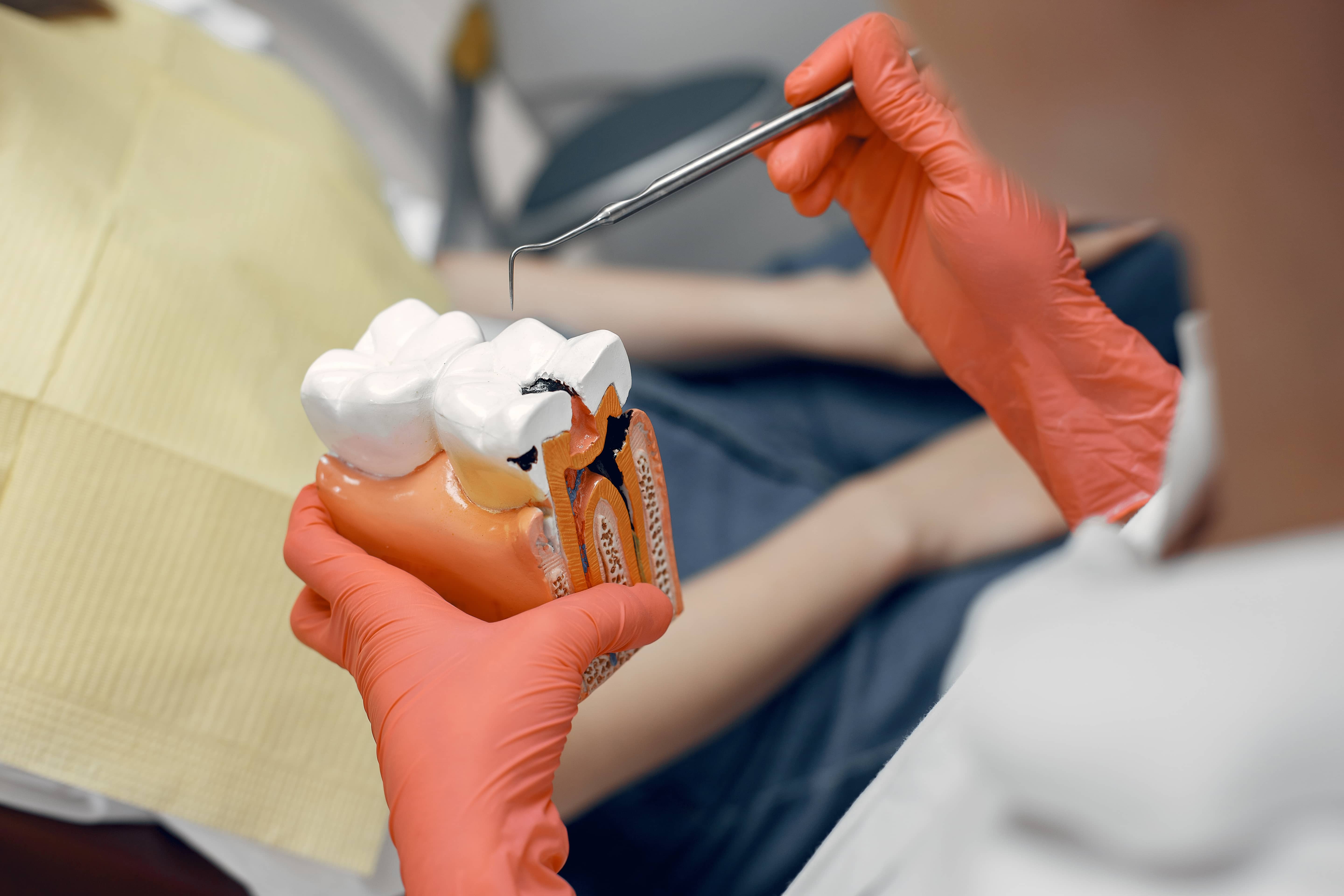 A dentist demonstrating root canal treatment on a dental model, showing molar preparation.