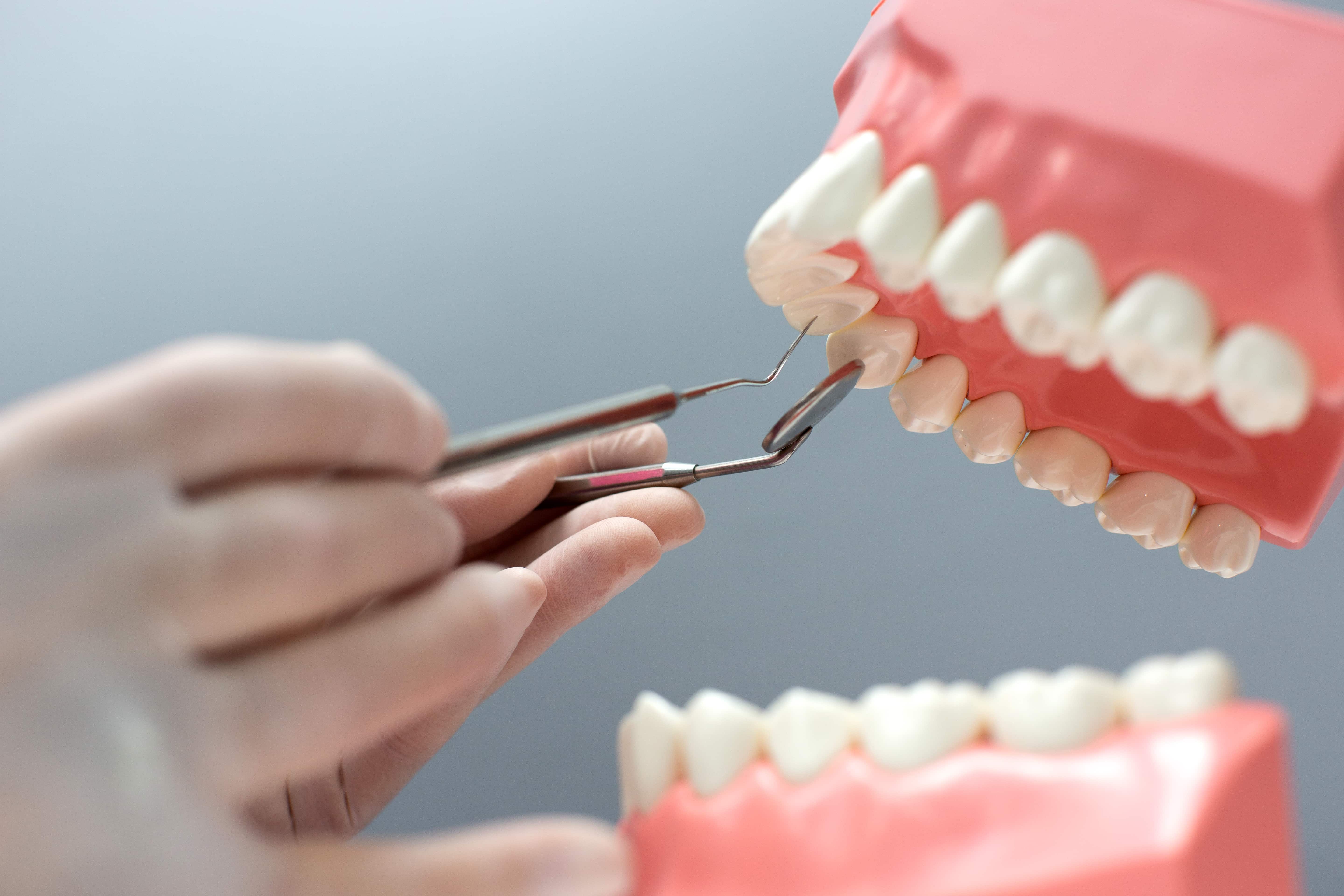 Dental tools inspecting tooth roots on a model, showing how apicoectomy targets infected root tips.