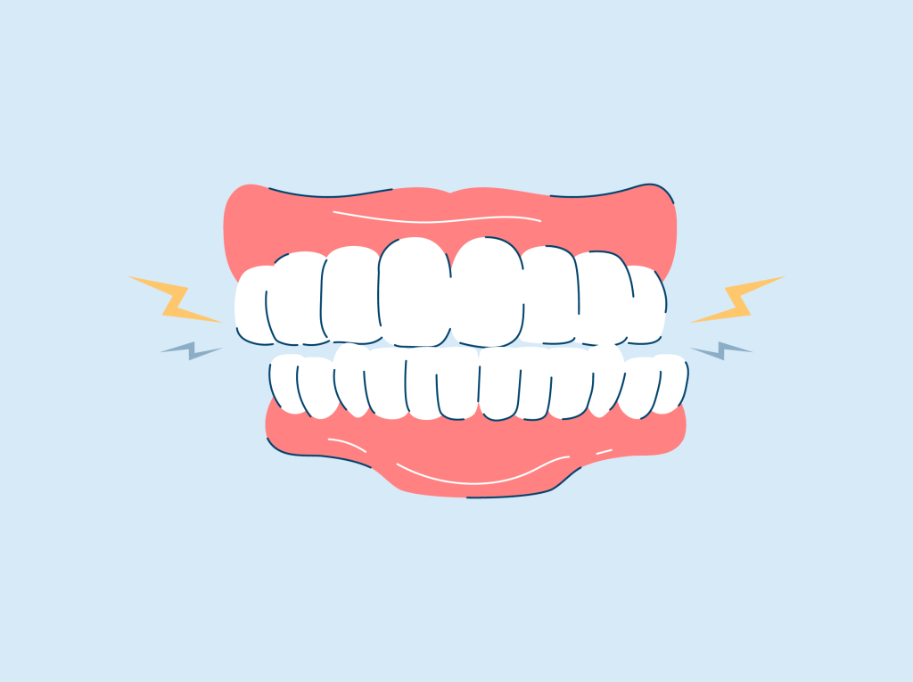 Top 8 Ways to Stop Teeth Grinding and Protect Your Smile