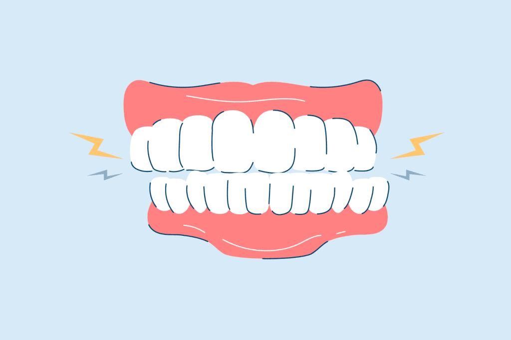 Top 8 Ways to Stop Teeth Grinding and Protect Your Smile