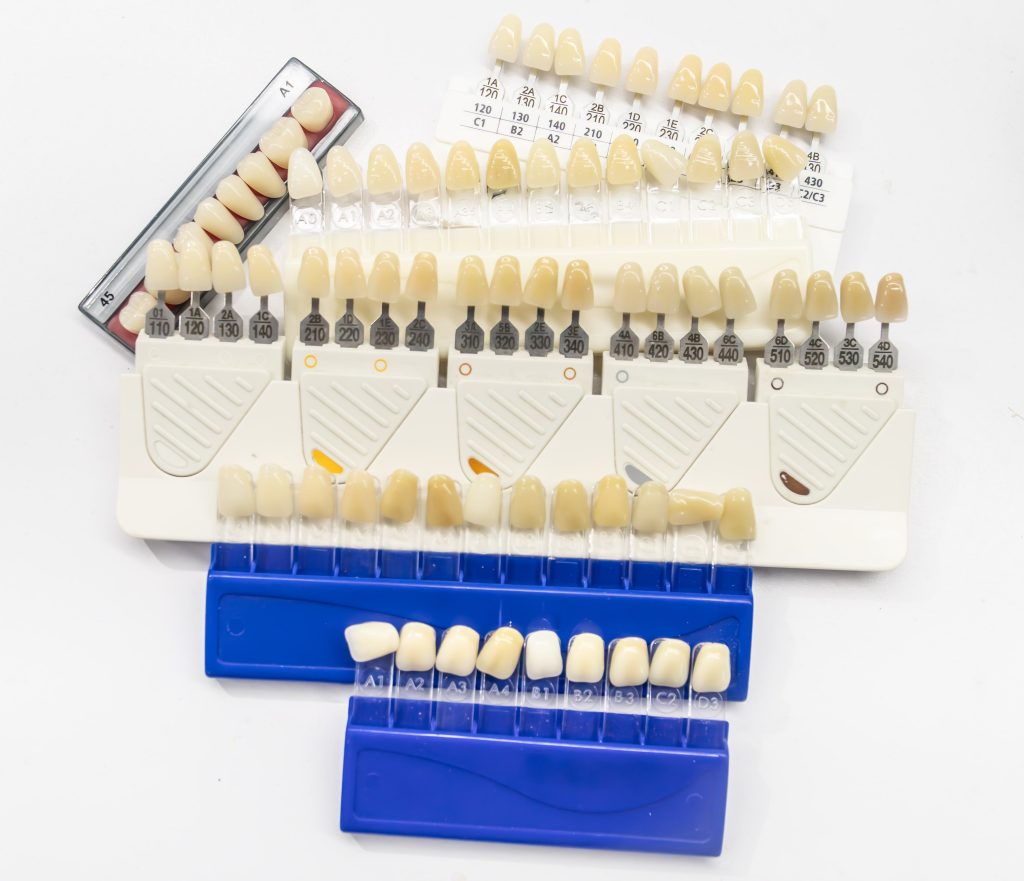 Veneer colour selection guide for natural-looking dental veneers