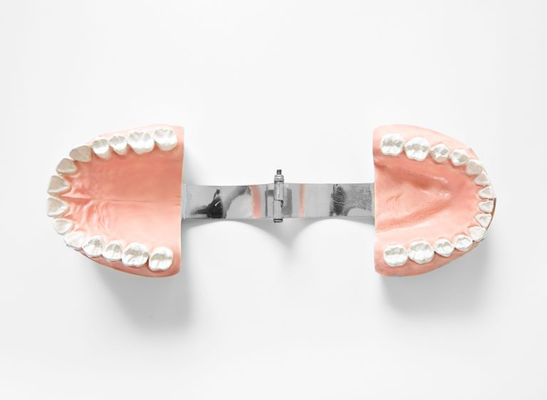 Upper jaw dental model with hinge scaled