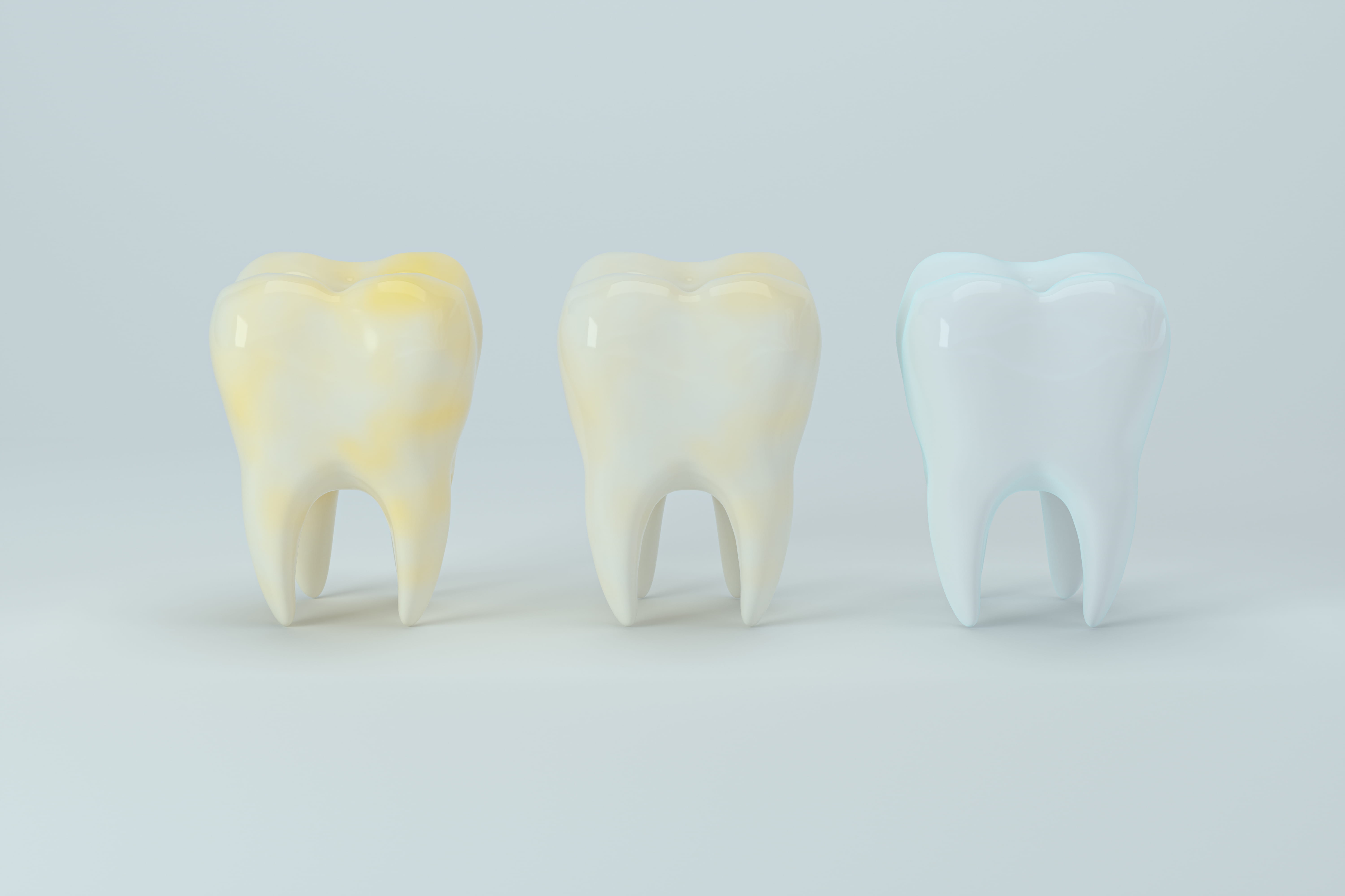 Three molar models showing progression from heavily yellow-stained teeth to bright white